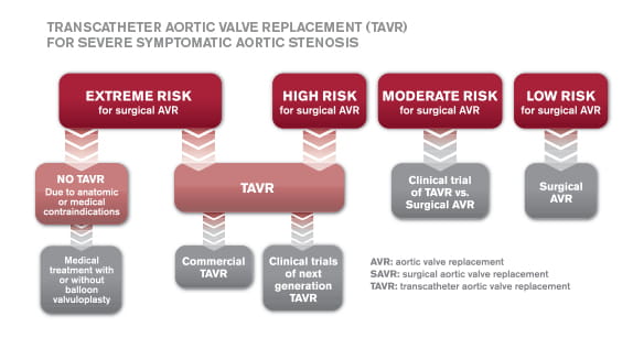 TAVR For Aortic Valve Stenosis | Houston Methodist