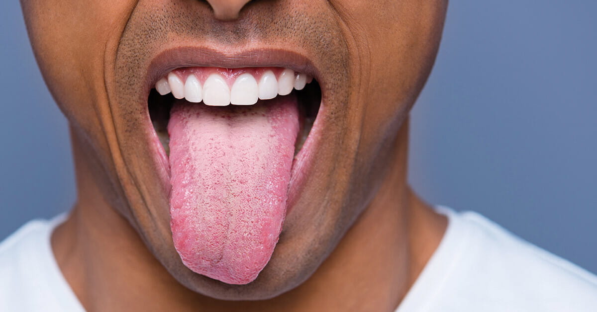 why-does-biting-your-tongue-hurt-so-much-houston-methodist-on-health