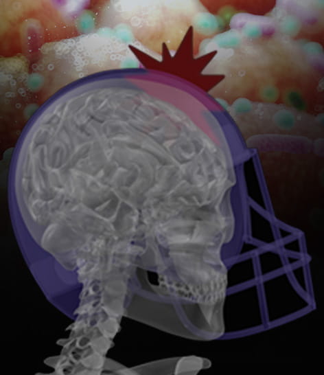 human skull protected by helmet