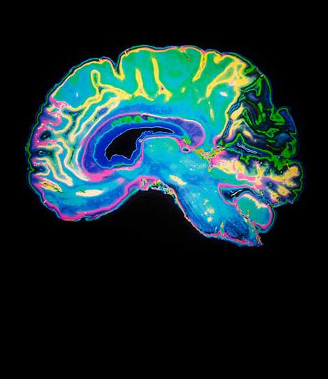 colorful brain scan