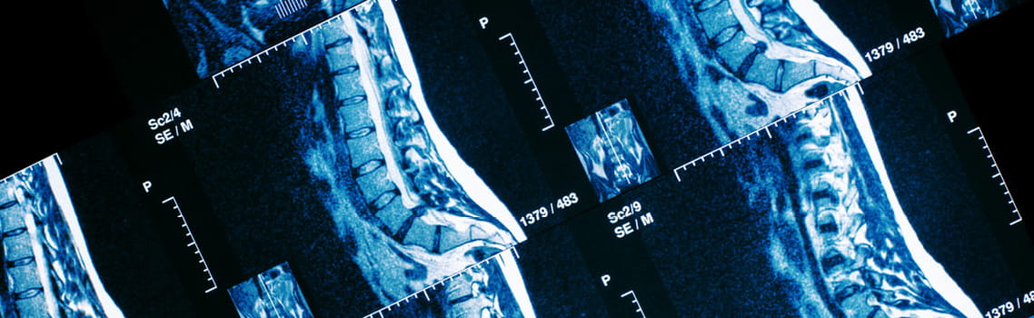 10 Best Practices to Keep Your Discs From Becoming Herniated: The Spine  Institute of Southeast Texas: Orthopedic Surgeons