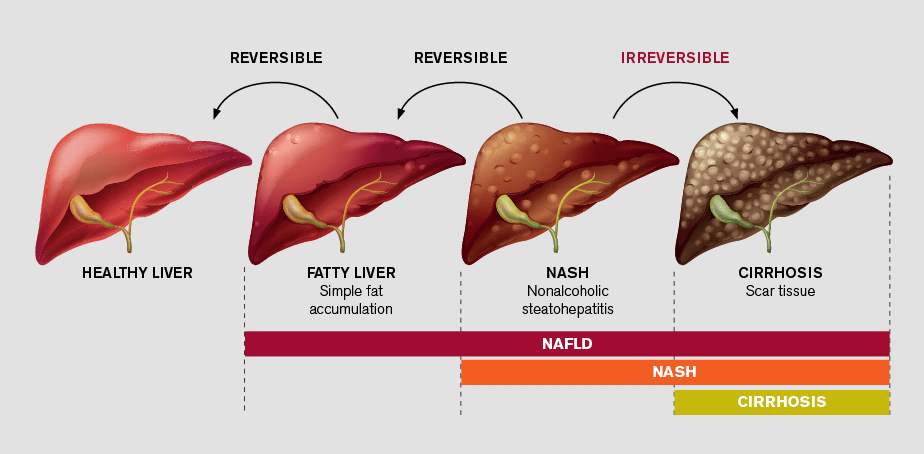 Metabolic Liver Disease Clinic | Houston Methodist