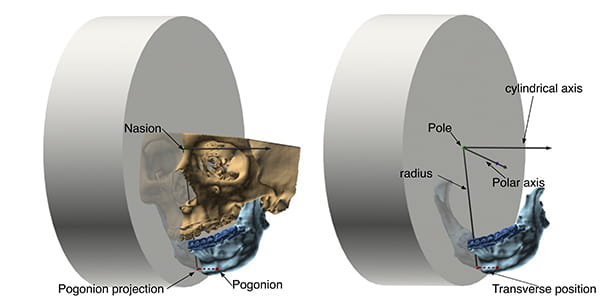 Figure 13