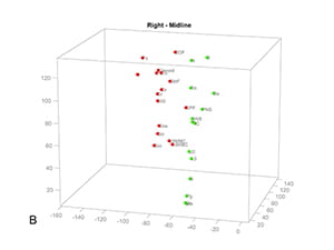 Figure 17B