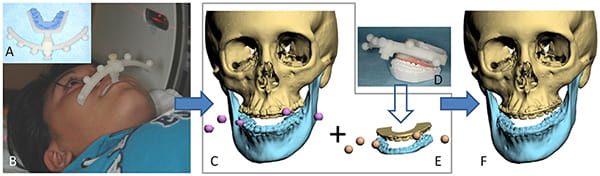 Figure 20