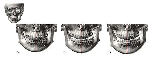 Figure 21