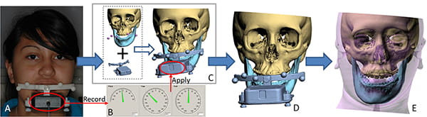 Figure 23