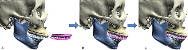 Figure 24