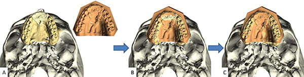 Figure 25