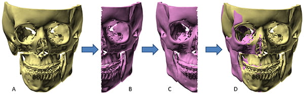 Figure 28