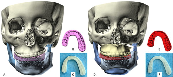 Figure 31