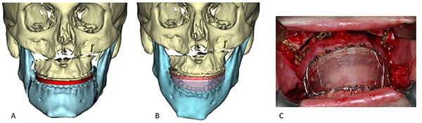 Figure 32