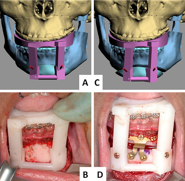 Figure 33